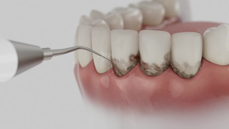 Reliable Emergency Dentist contractor in Ceres, CA by Smile Center Dentistry